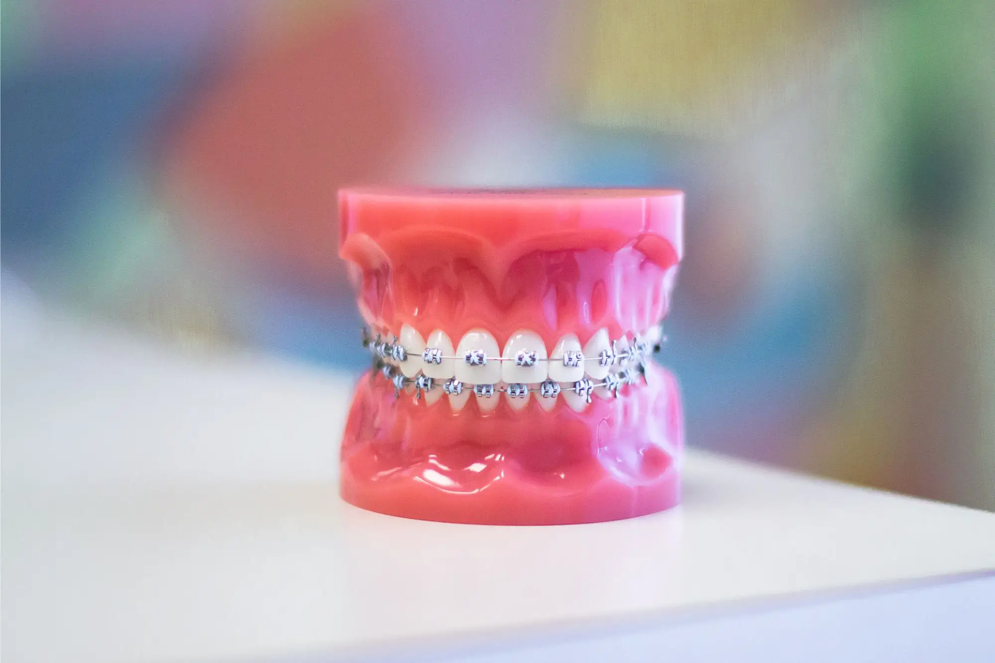 metal braces